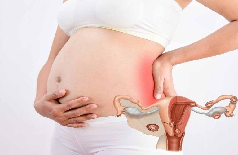 Bệnh viêm vùng chậu mang thai được không?