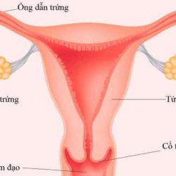 Viêm ống dẫn trứng là bệnh gì? Nguyên nhân, biến chứng & cách điều trị