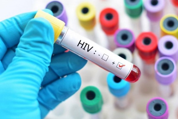 Tăng nguy cơ lây nhiễm HIV