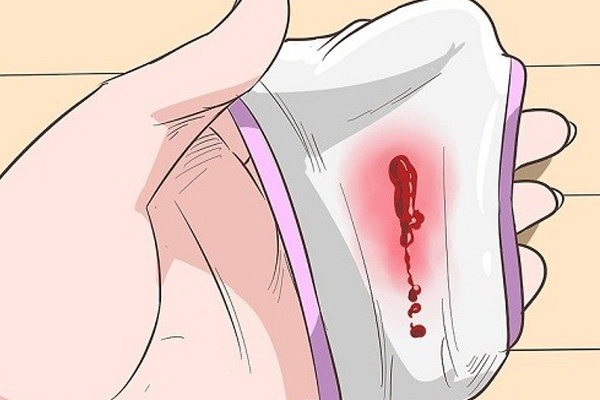 Viêm lộ tuyến cổ tử cung bị ra máu là nặng hay nhẹ?