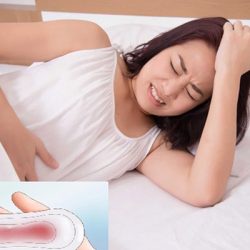 Polyp cổ tử cung gây chảy máu, chị em chớ nên chủ quan!