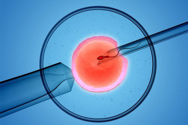 Giải pháp thụ tinh trong ống nghiệm (IVF):